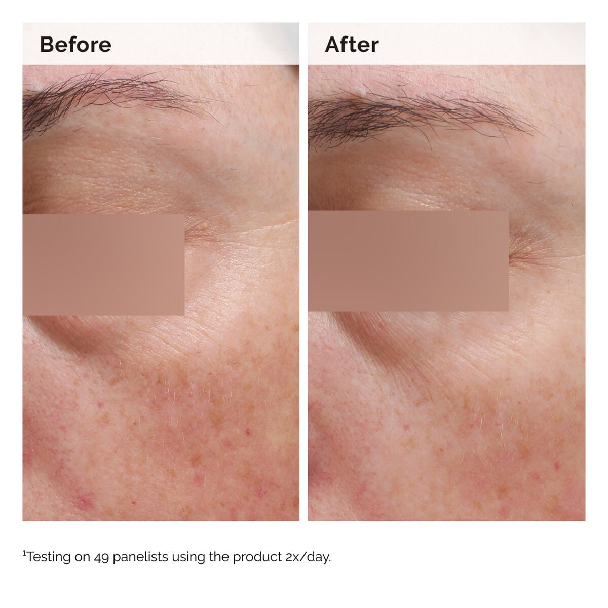 niacinamide-5-face-and-body-emulsion-f7 2024-08-23-ORD-Nia-5pct-Face-Body-B-A-Elasticity-Global-02-1x1.jpg