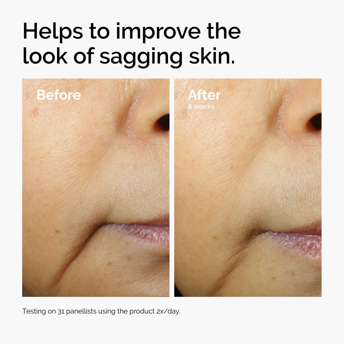 caffeine-3-escin-1-face-serum-k5 ord-caffeine-3pct-escin-1pct-face-serum-before-after-sagging.jpg