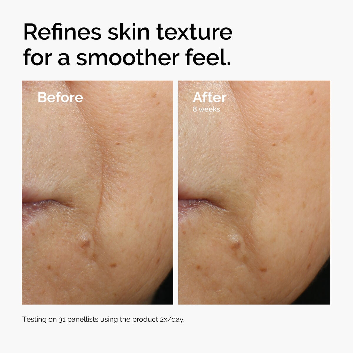 caffeine-3-escin-1-face-serum-k5 ord-caffeine-3pct-escin-1pct-face-serum-before-after-texture.jpg