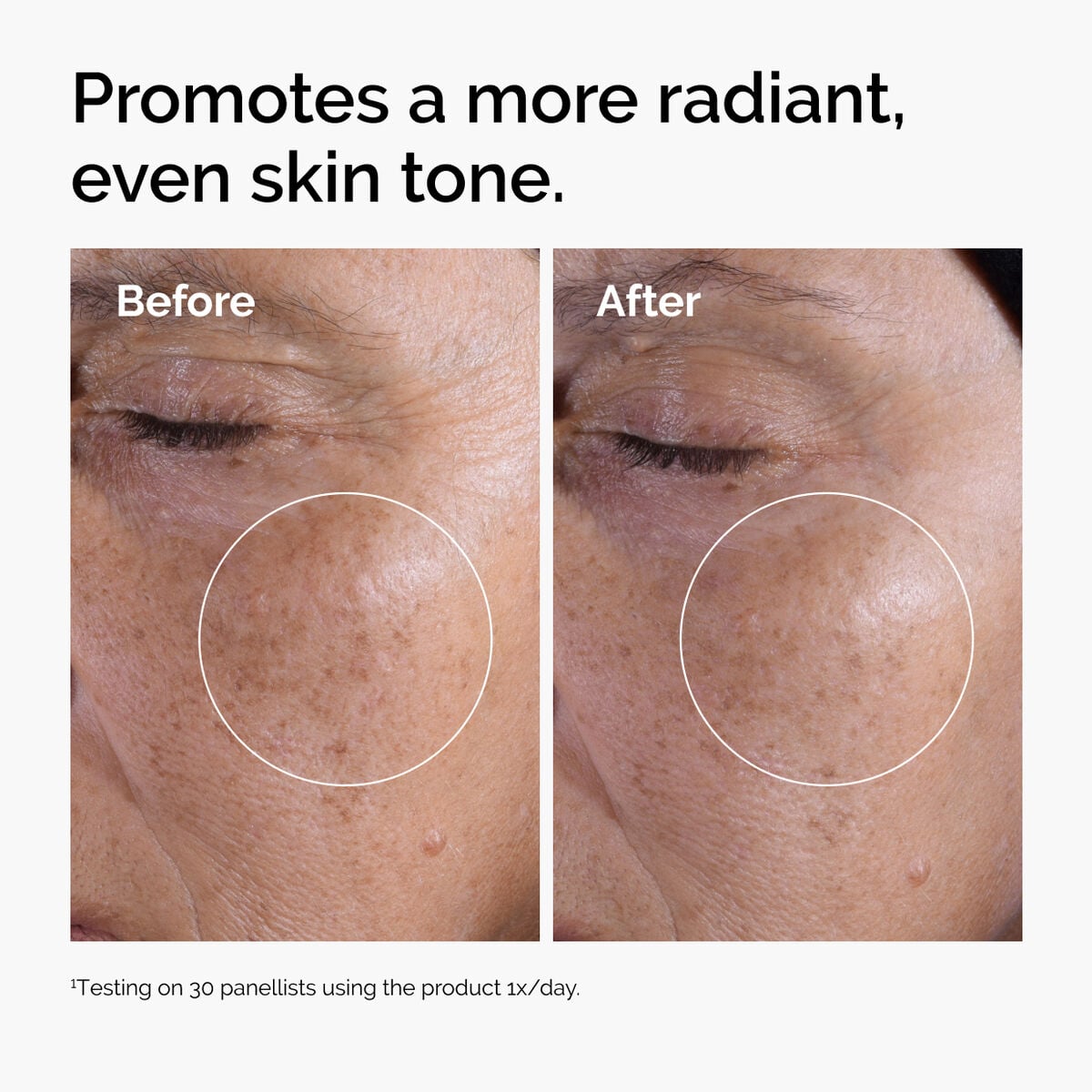 glycolic-acid-7-exfoliating-toner-m8 ord-glycolic-before-after-radiance.jpg