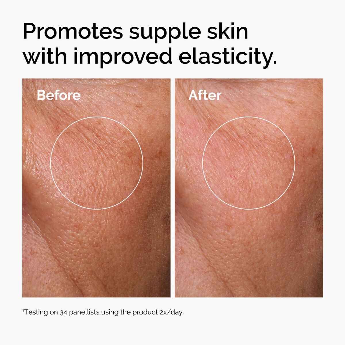 hyaluronic-acid-2-b5-with-ceramides-o5 ord-hyaluronic-acid-2pct-b5-hydrating-serum-before-after-elasticity.jpg