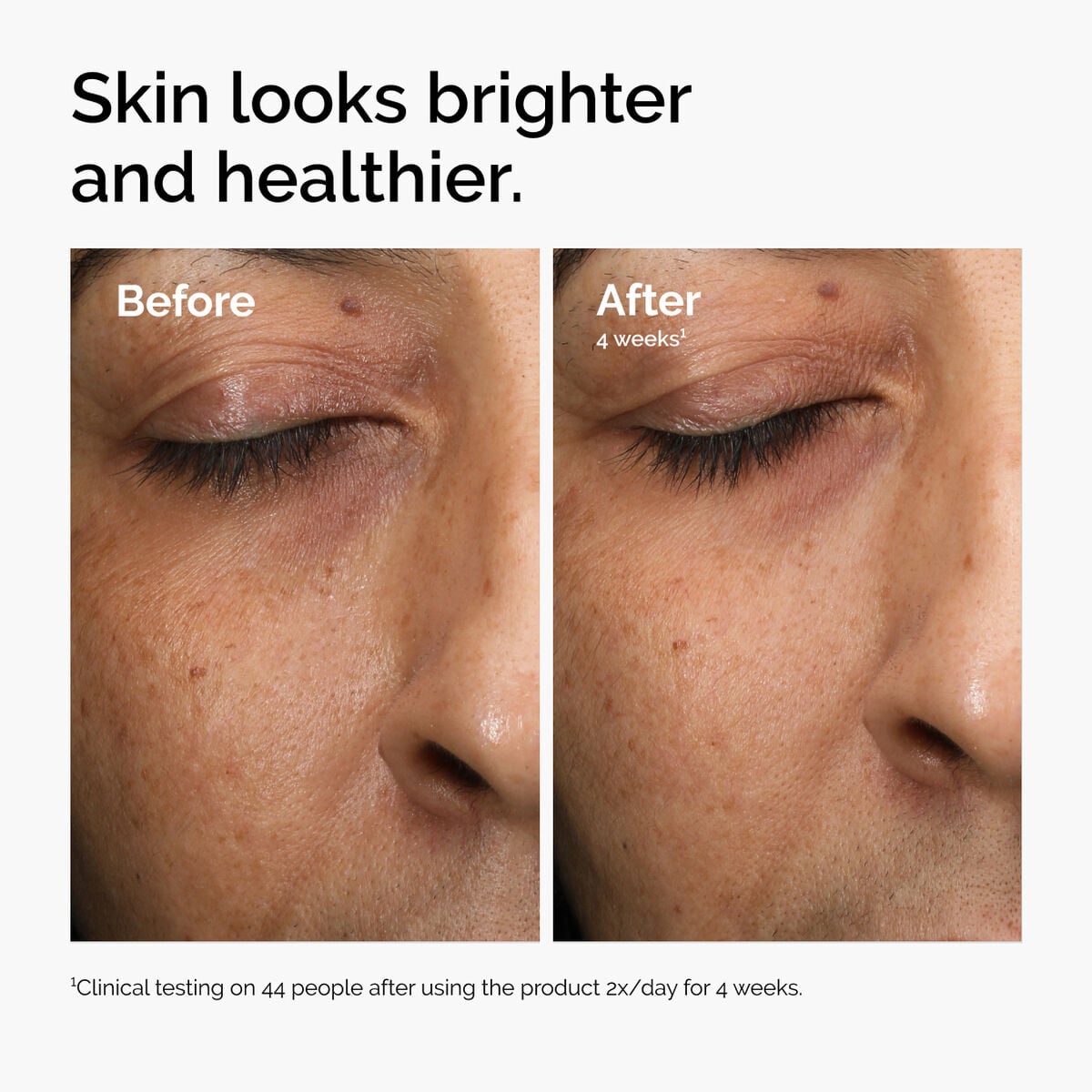 multi-antioxidant-radiance-serum-u7 ord-mars-before-after-healthy.jpg