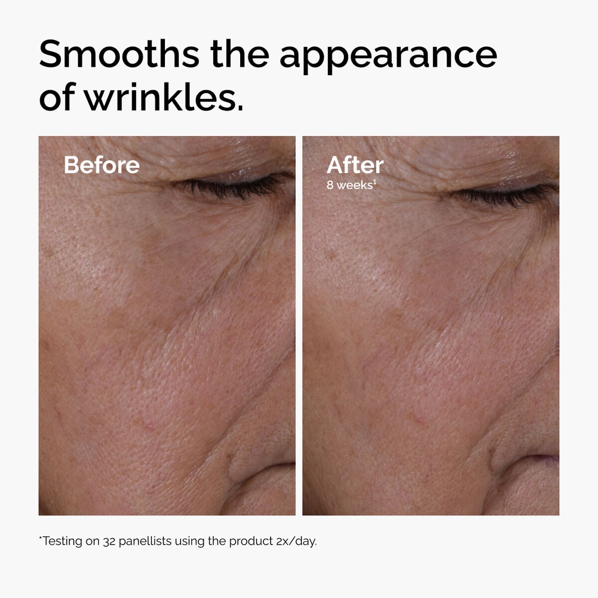 multi-peptide-ha-serum-v4 ord-multi-peptide-ha-serum-wrinkles-before-after.jpg