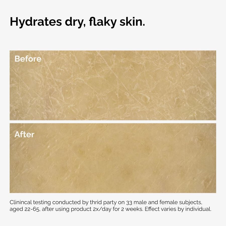 the-body-care-collection-m6 ord-natural-moisturizing-factors-inulin-body-before-after-graphic-02.jpg