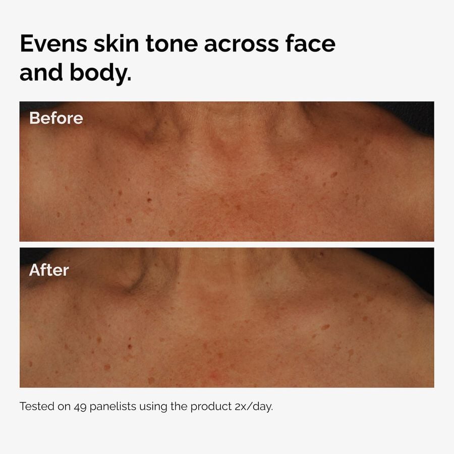 the-body-care-collection-m6 ord-niacinamide-face-body-serum-before-after-even-tone-graphic.jpg