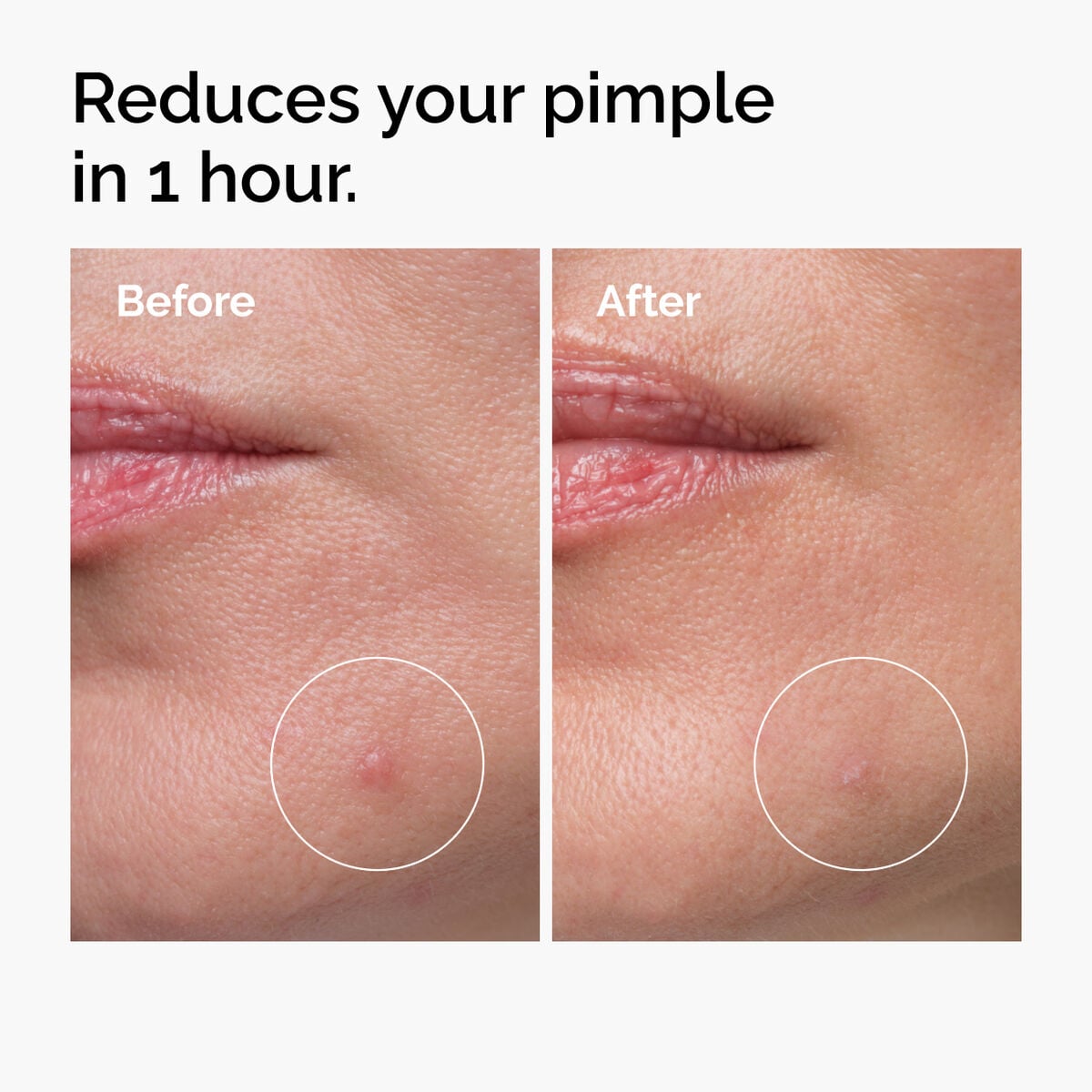 sulfur-10-powder-to-cream-concentrate-r3 ord-sulfur-10pct-powder-to-cream-concentrate-before-after-NA.jpg